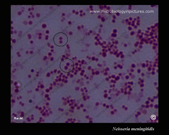 Neisseria Meningitidis Microscopy Gram Stain 3838